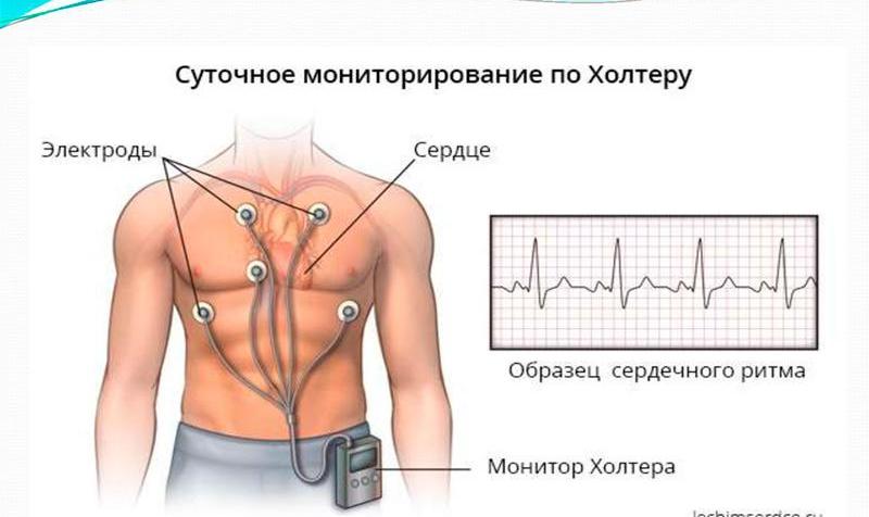 Какую диагностику сердца